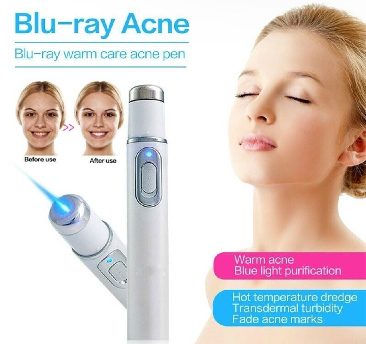 Blue Light Acne Treatment Pens