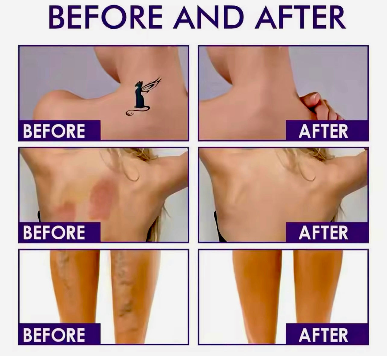 Body Coverage Perfector & Skin Concealer