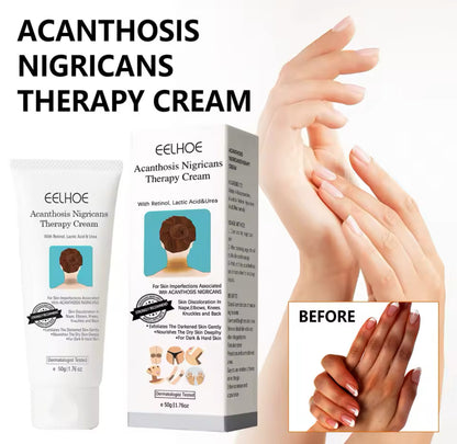 Black Acanthoderma Brightening Repair Cream