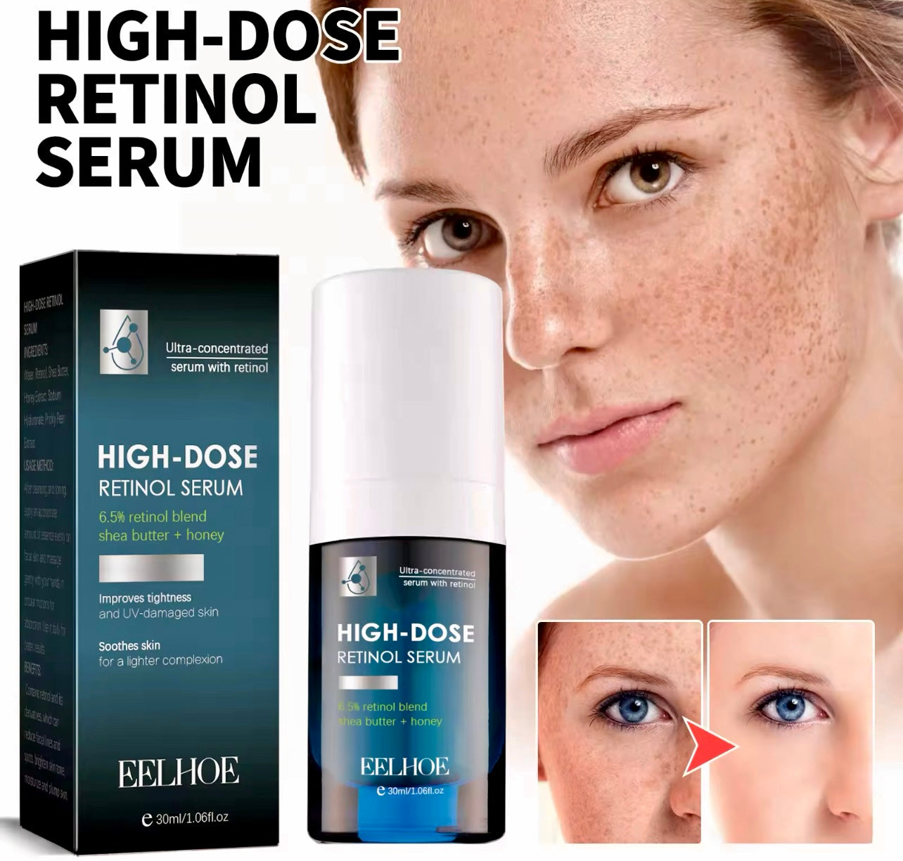 Retinol Face Serum Dark Spot Remover & Acne Mark Fader