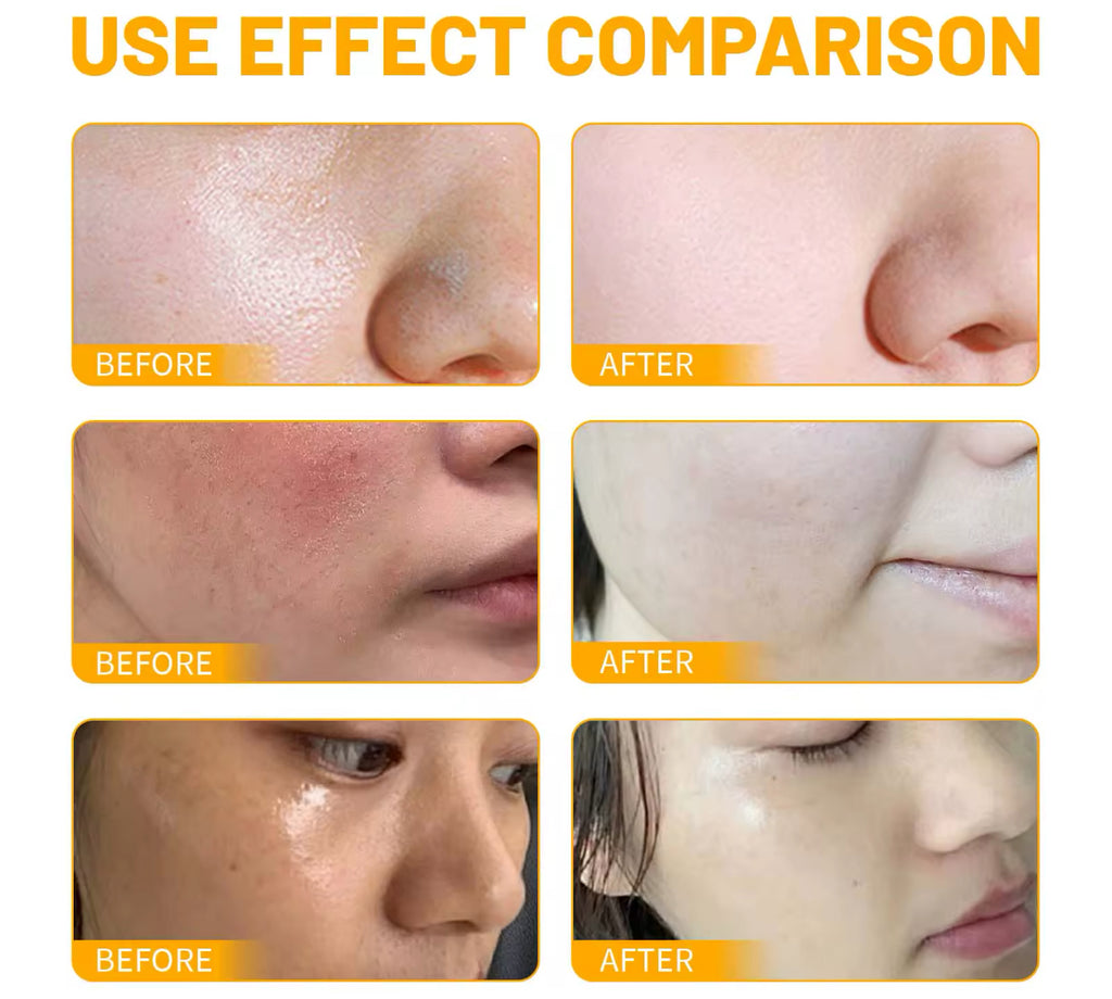 Turmeric Deep Cleansing Face Wash Brightening & Acne Mark Removal