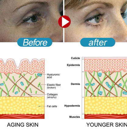 Retinol Anti-Wrinkle Lifting Cream Hydrating & Firming Formula