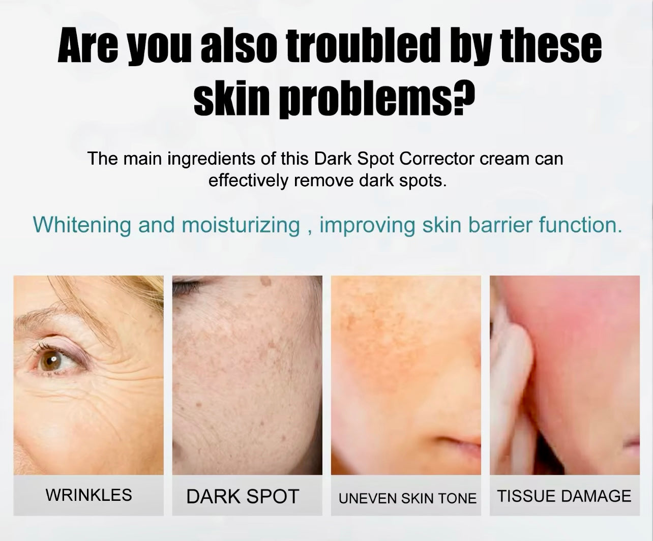 Dark Spot Remover Cream Acne Mark & Blemish Corrector