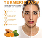 Turmeric Exfoliating Pads 55PCS with Kojic Acid for Oil Control & Dead Skin Removal