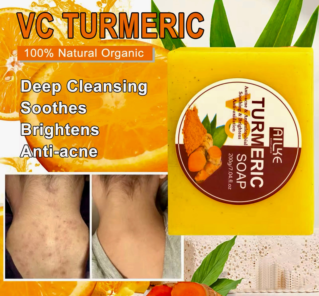 Organic Turmeric Skin Care Set Acne Control & Brightening