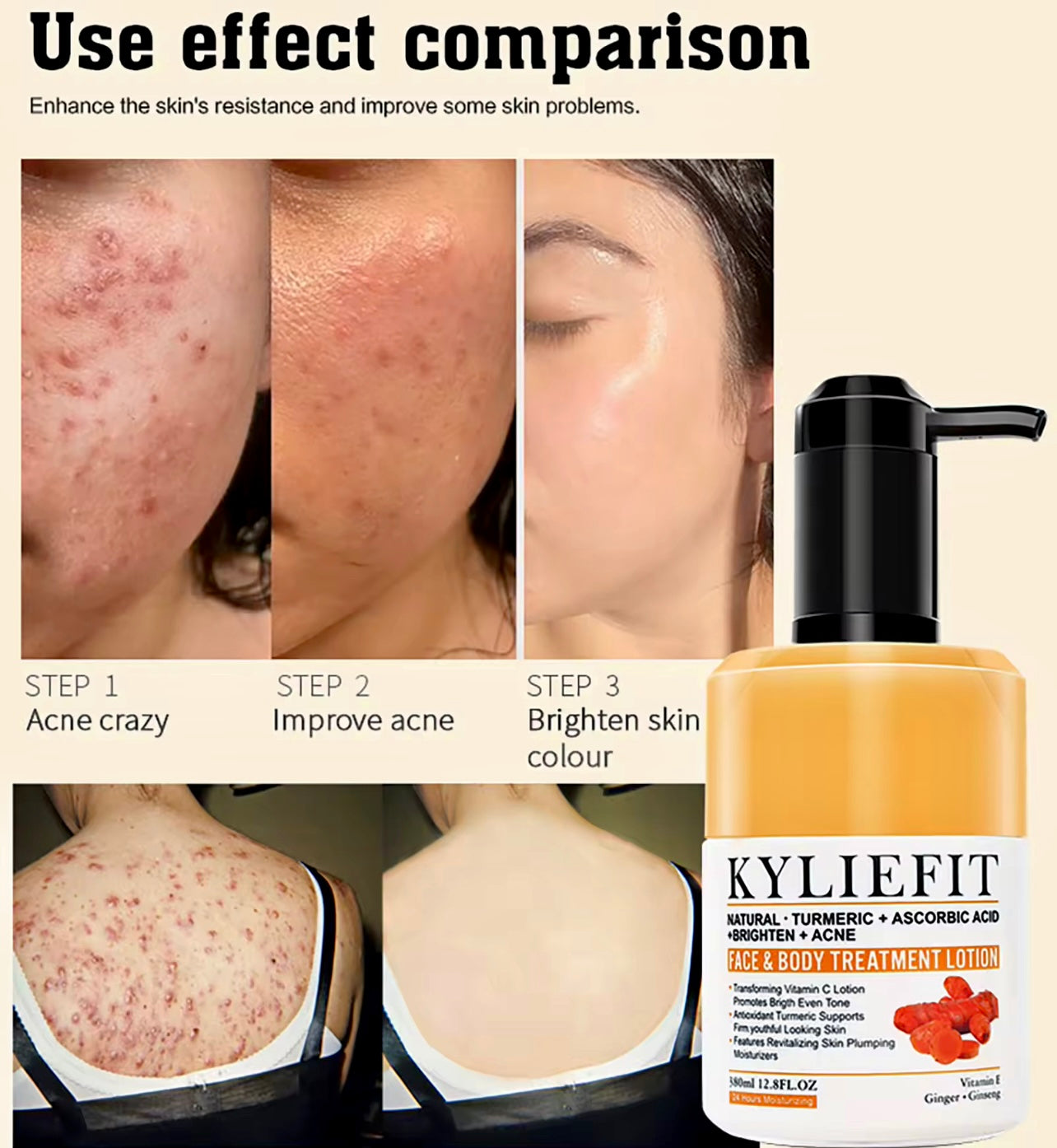 Organic Turmeric Skin Care Set Acne Control & Brightening