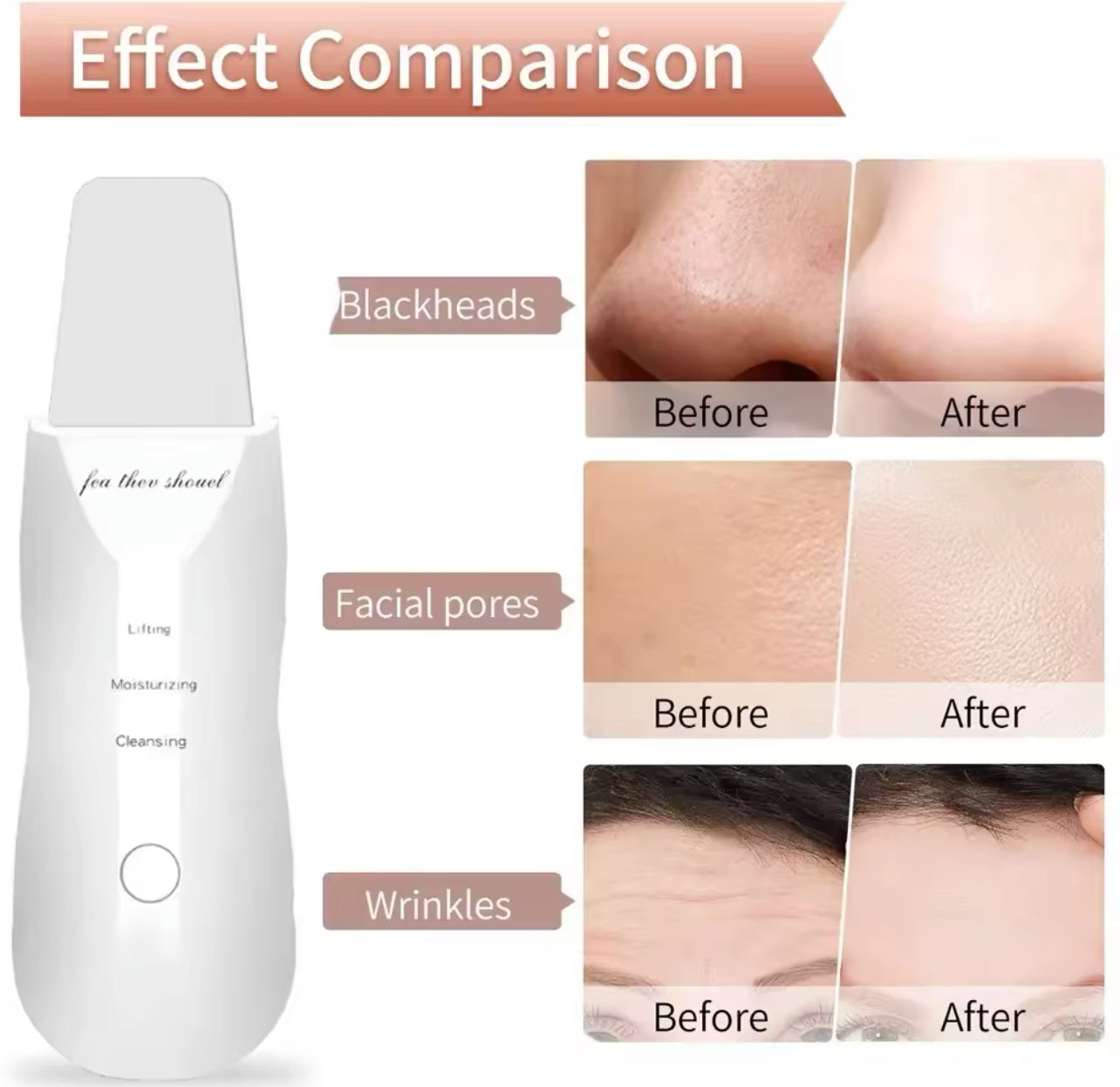 Ultrasonic Skin Scraper Deep Cleaning & Blackhead Remover Facial Spatula