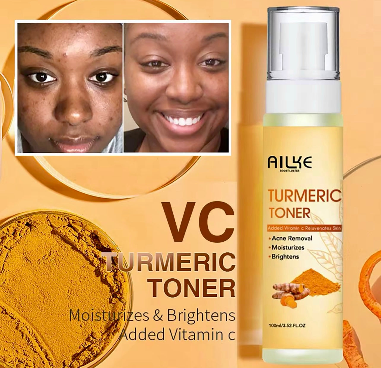 Organic Turmeric Skin Care Set Acne Control & Brightening