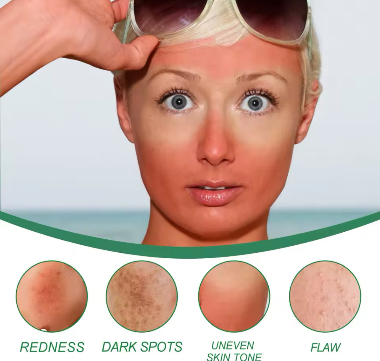 Redness Repair & Color Correcting Face Cream 100g