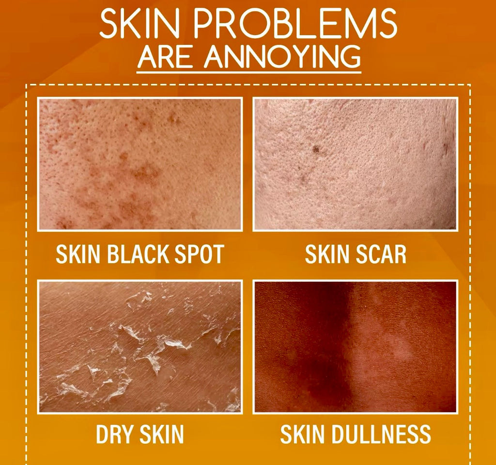 Orange Exfoliating Peeling Lotion Gentle Brightening & Moisturizing Body Cream