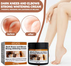 Kojic Acid Whitening Cream Brighten & Even Skin Tone