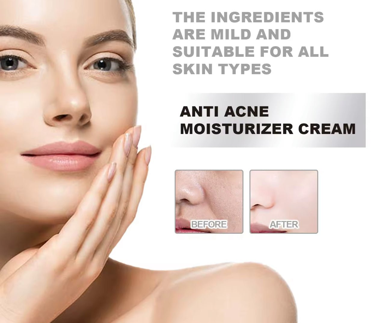 Hydrating & Acne Repair Face Cream