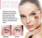 Retinol Eye Cream Stick Dark Circle & Fine Line Reducer