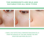 Herbal Exfoliating Gel Deep Cleansing & Blackhead Removal