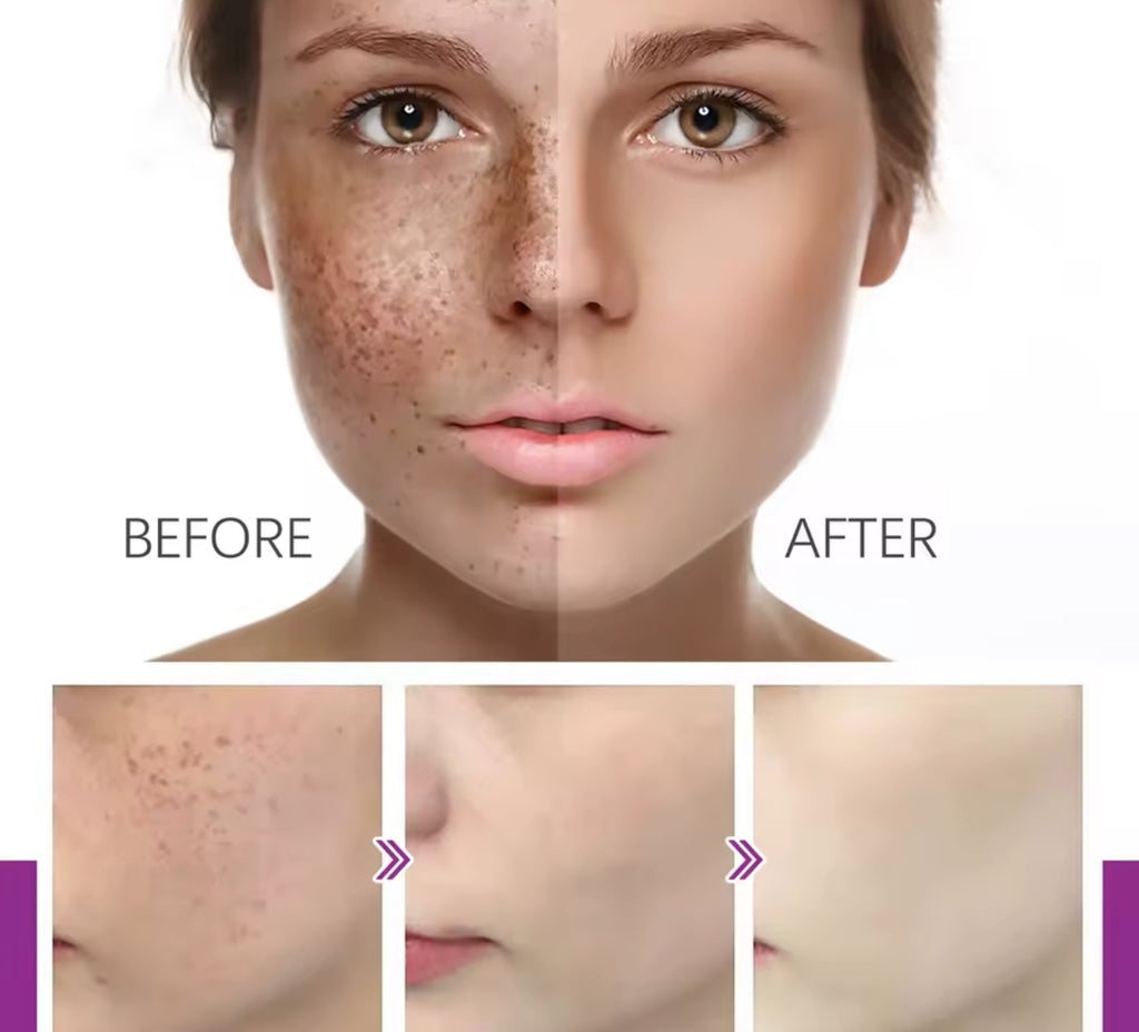 Acne Repair & Oil Control Cream Fights Redness, Shrinks Pores, and Fades Spots