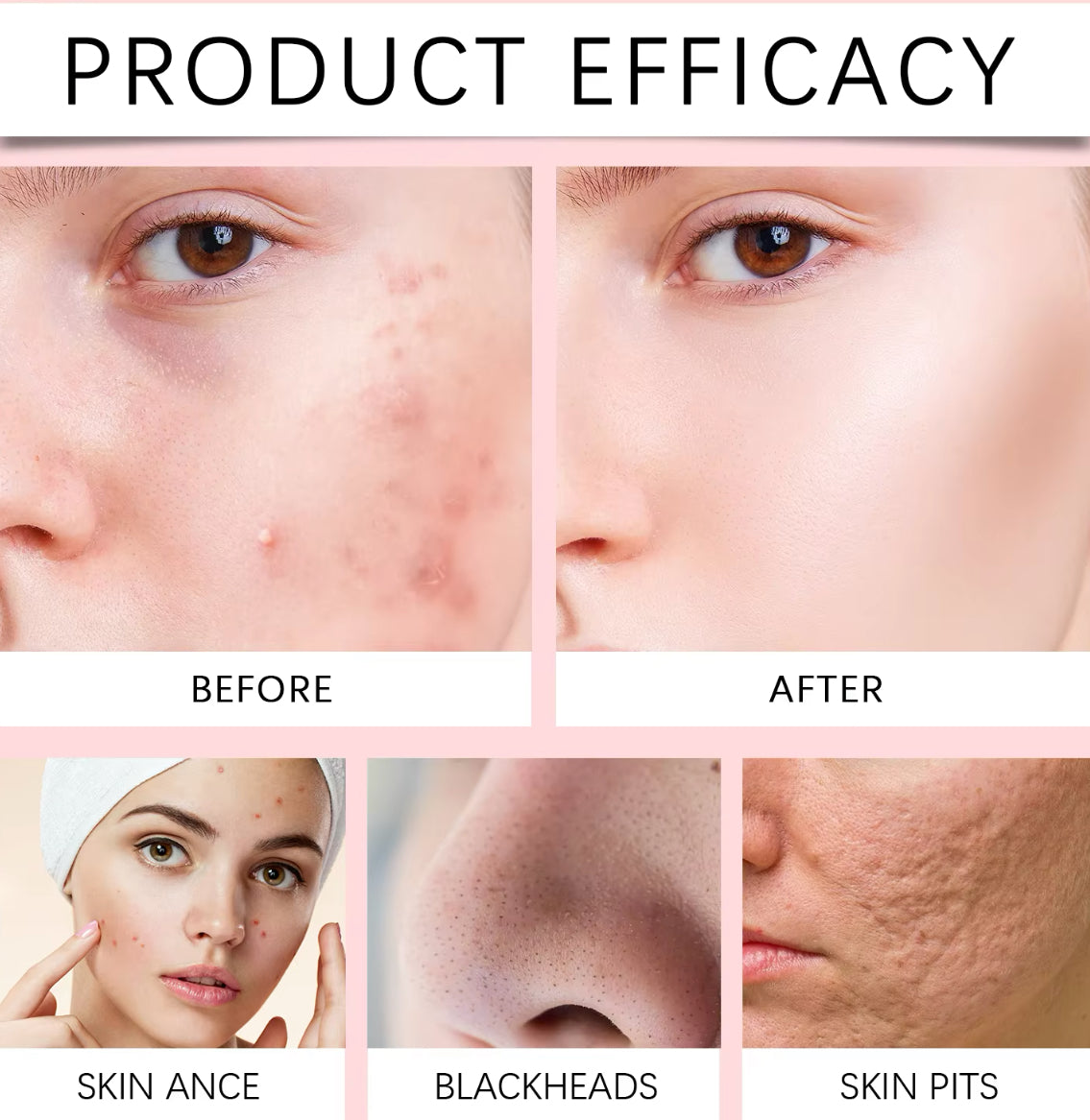 Revitalizing Organic Salicylic Acid Foaming Face Cleanser – 4-in-1 Hydrating Mousse