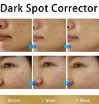 Dark Spot Corrector Repair Cream Tone Evening & Hydrating Formula