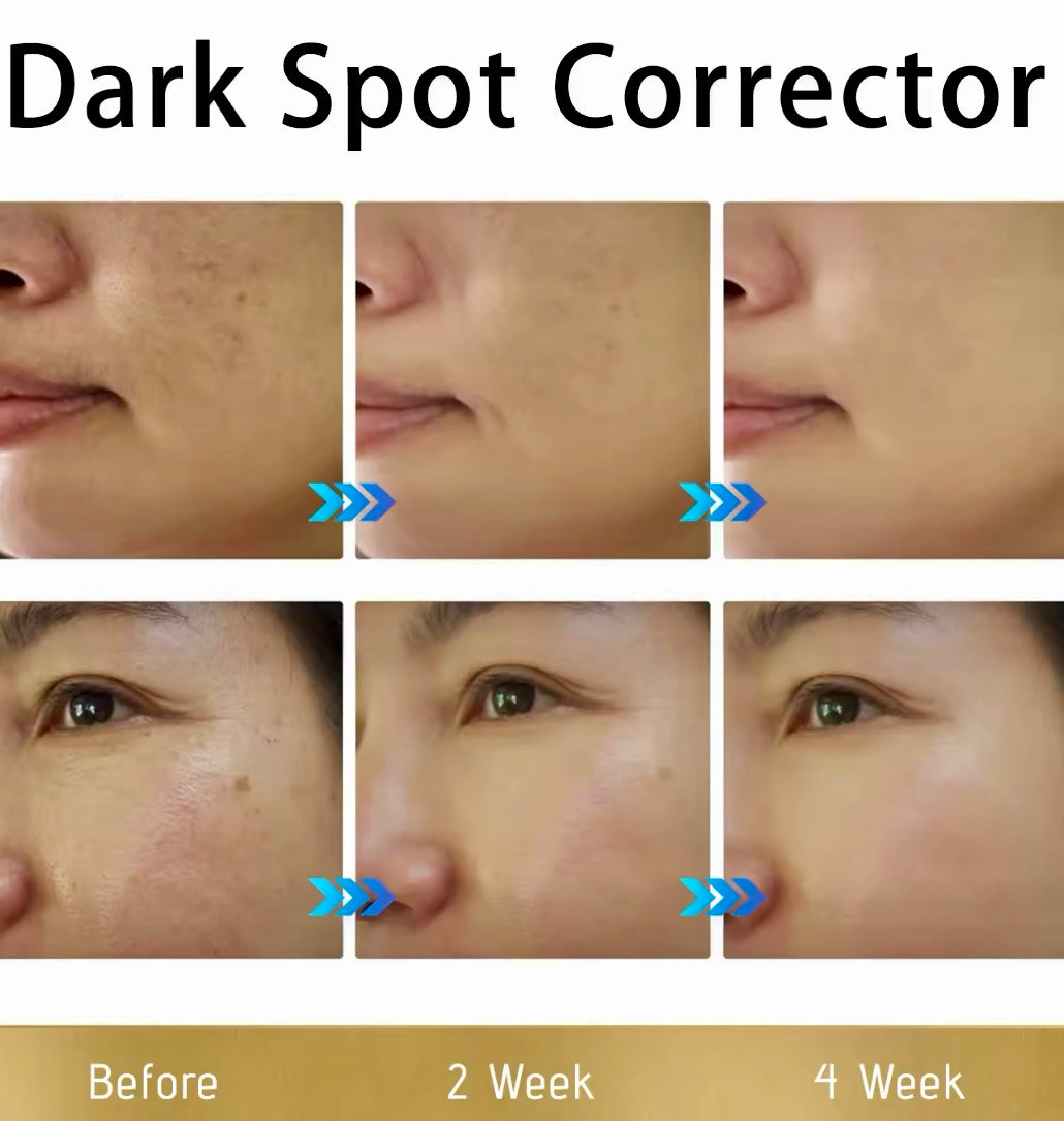 Dark Spot Corrector Repair Cream Tone Evening & Hydrating Formula