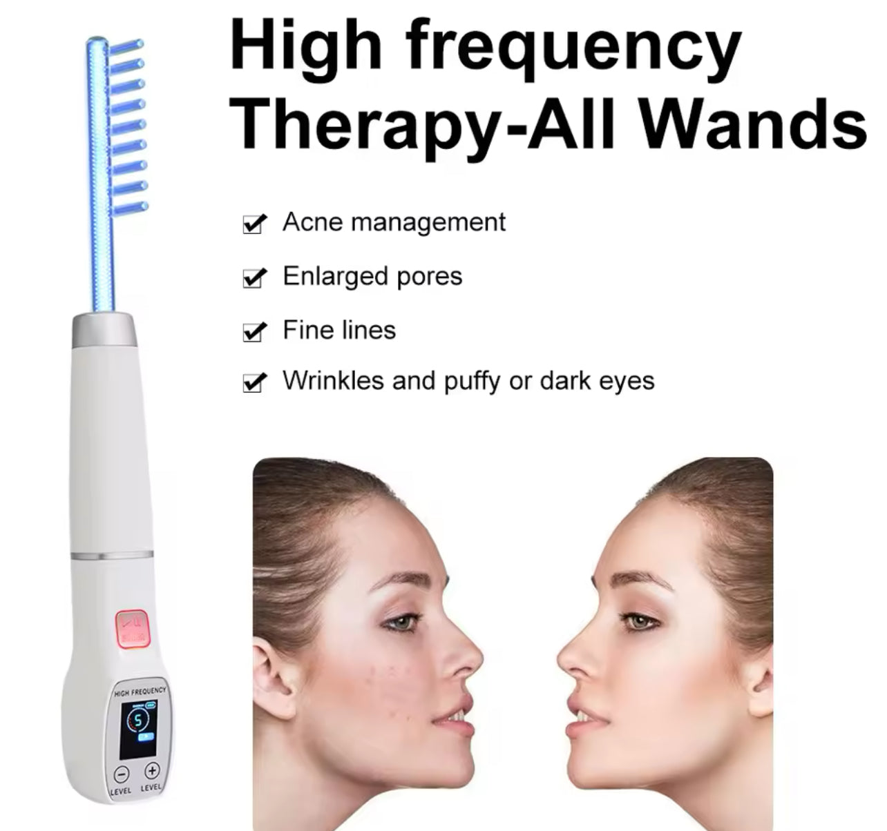 High Frequency Electrode Wand Glass Tube Acne Spot Remover