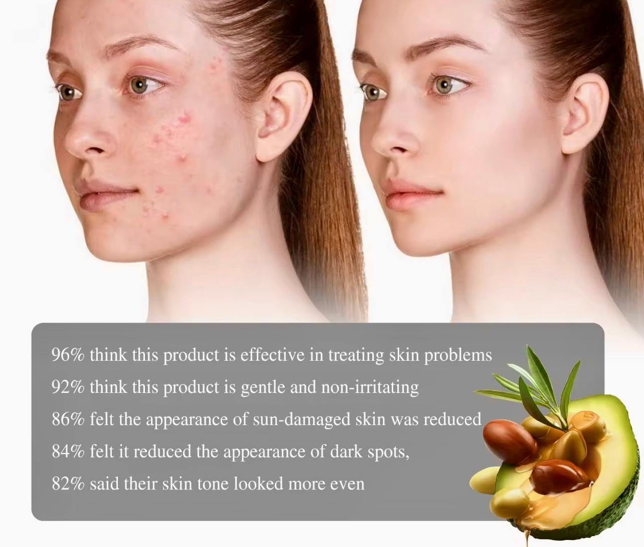 Retinol Face Serum Dark Spot Remover & Acne Mark Fader