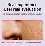 Blackhead Remover with Camera Pore Vacuum Tool with 3 Modes & 6 Heads