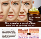 Retinol Wrinkle Removal Cream Firming, Lifting & Anti-Aging