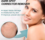Dark Spot Remover Cream Acne Mark & Blemish Corrector