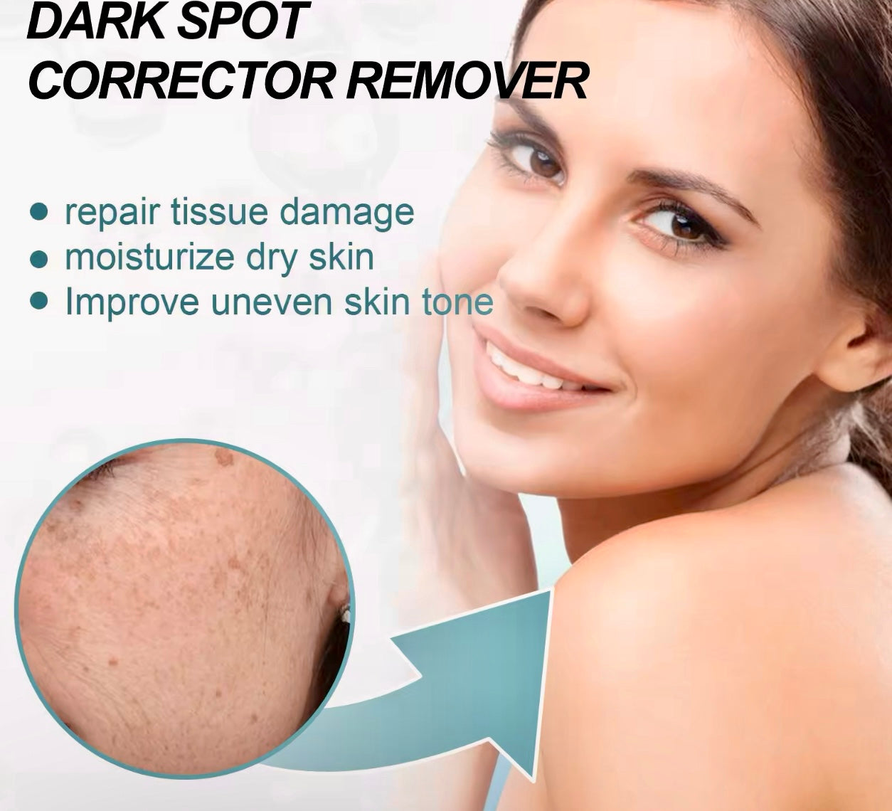 Dark Spot Remover Cream Acne Mark & Blemish Corrector