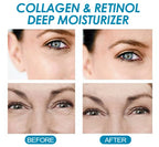 Retinol Anti-Wrinkle Lifting Cream Hydrating & Firming Formula