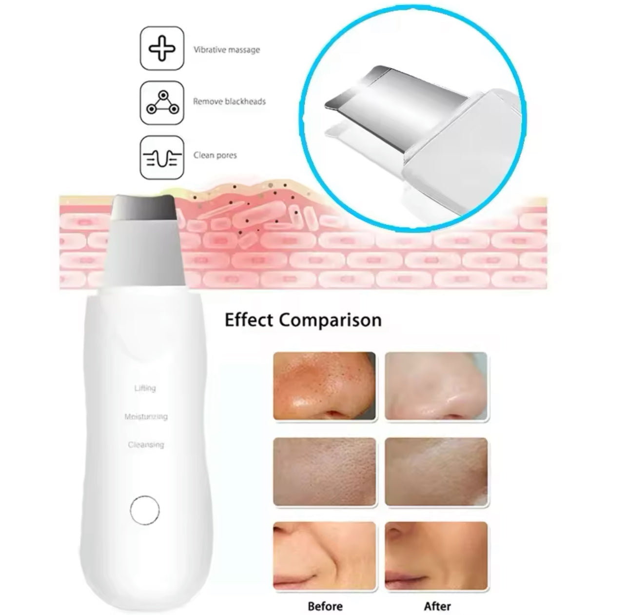 Professional Ultrasonic Facial Skin Scrubber Rechargeable Deep Cleansing Device