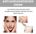 Hydrating & Acne Repair Face Cream