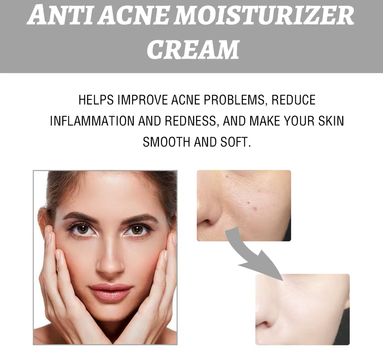 Hydrating & Acne Repair Face Cream