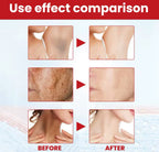 Black Spot Repair Cream Brightening & Moisturizing