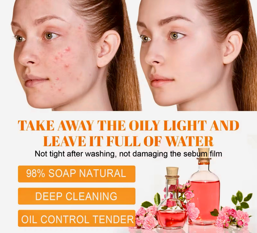 Hoygi Turmeric Facial Cleanser Oil Control & Acne Care