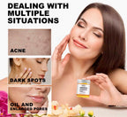 Turmeric Exfoliating Pads 55PCS with Kojic Acid for Oil Control & Dead Skin Removal