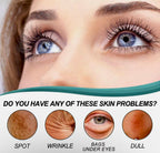 Dark Spot Remover Cream Acne Mark & Blemish Corrector