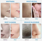 6-in-1 Hydrodermabrasion Machine Hydro Water Jet Peel & Skin Whitening Device