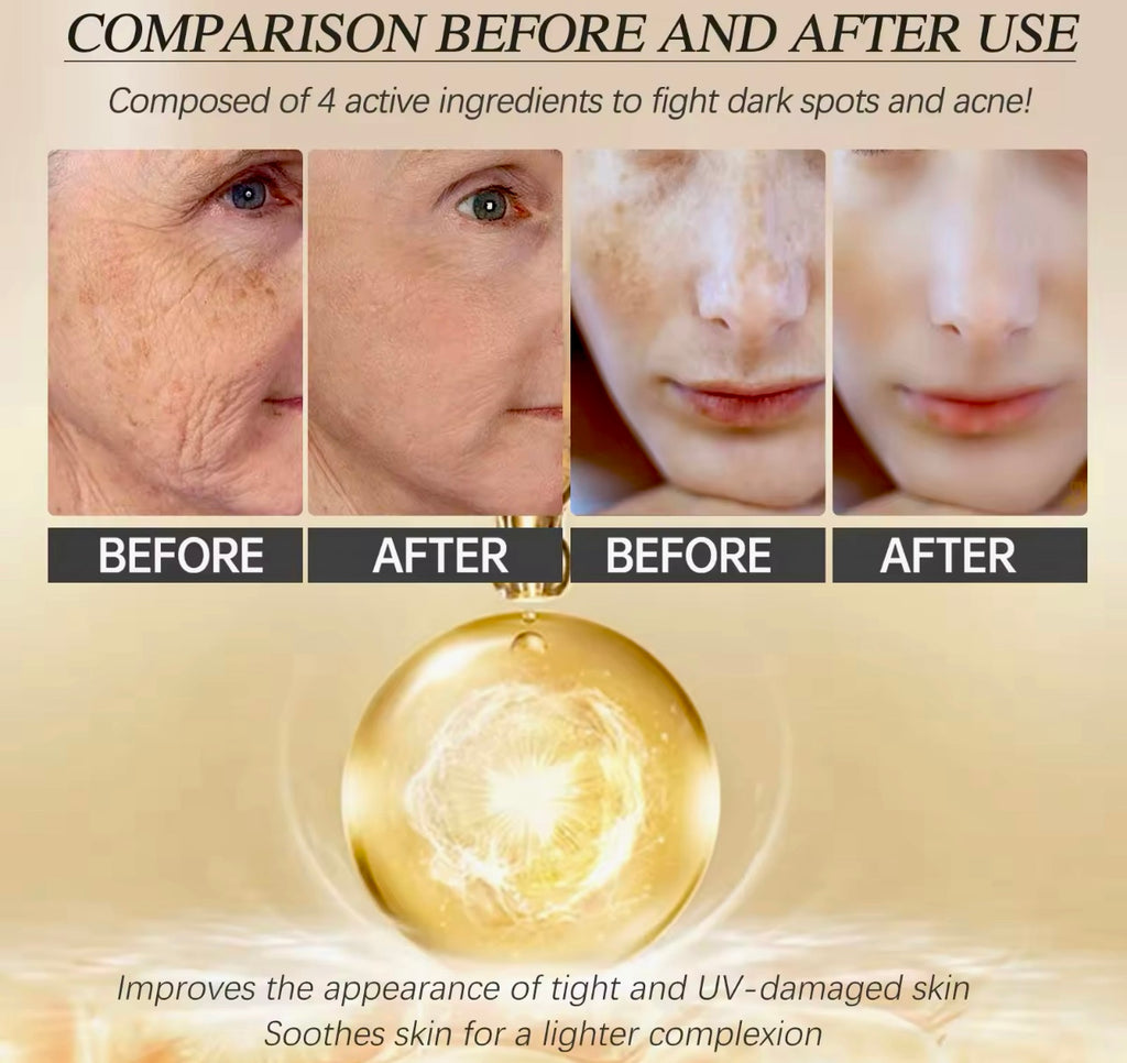 Retinol Face Serum Dark Spot Remover & Acne Mark Fader