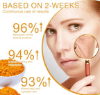 Vitamin C & Turmeric Brightening Face Cream Dark Spot & Wrinkle Care
