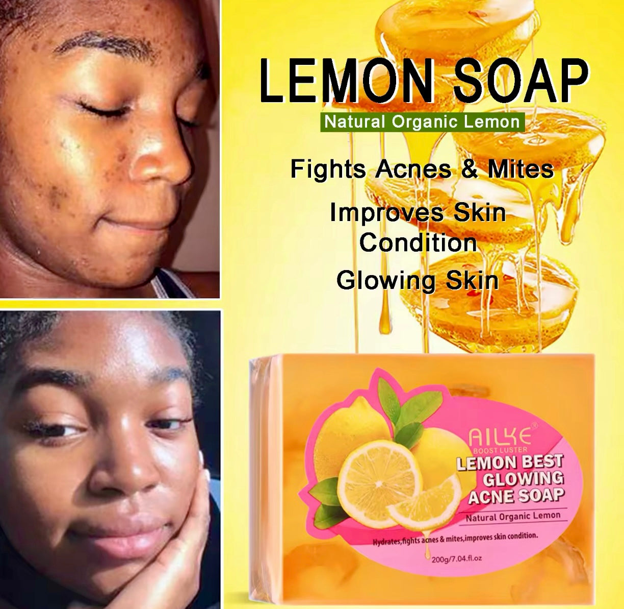 Organic Lemon Whitening Soap Acne & Dark Spot Remover