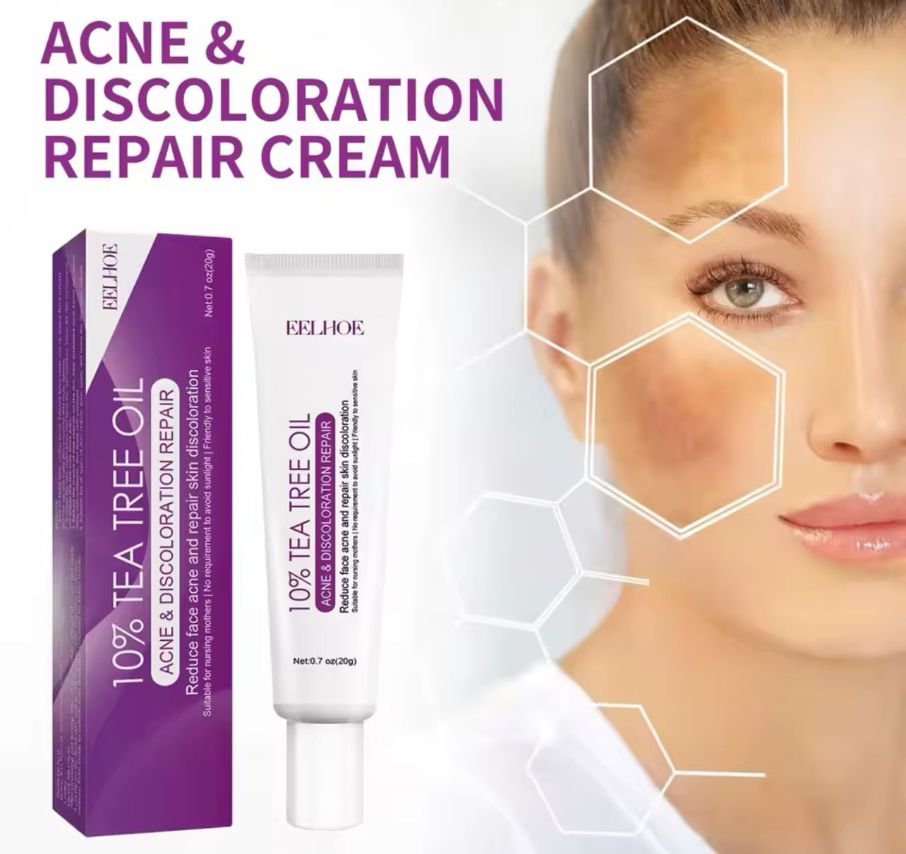 Acne Repair & Oil Control Cream Fights Redness, Shrinks Pores, and Fades Spots