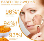 Hoygi Turmeric Facial Cleanser Oil Control & Acne Care