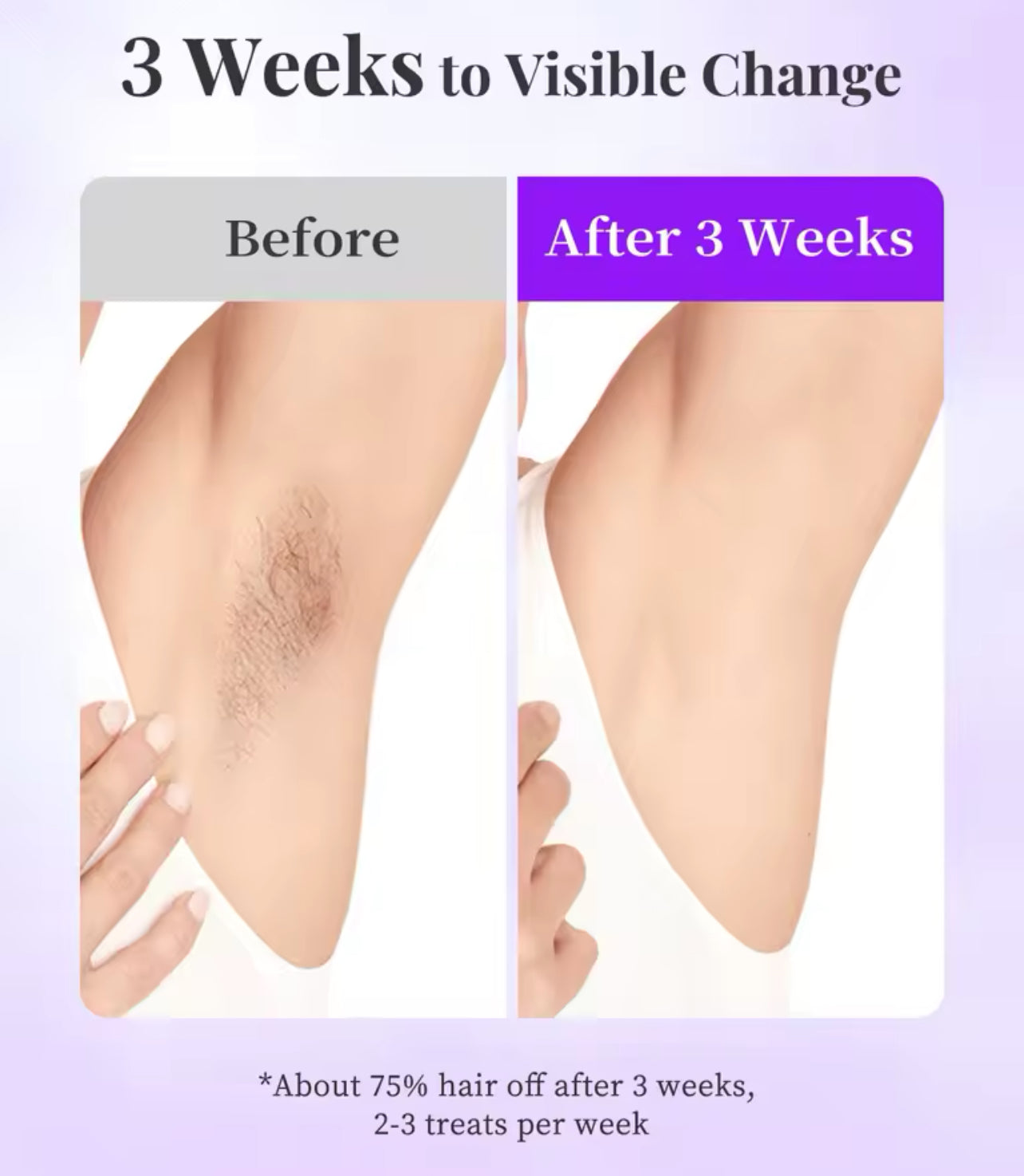 Hikyskin IPL Laser Hair Removal System Painless Home Device with Sapphire Ice-Cooling