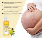 Stretch Mark Lightening Essential Oil Cream Moisturizing & Firming