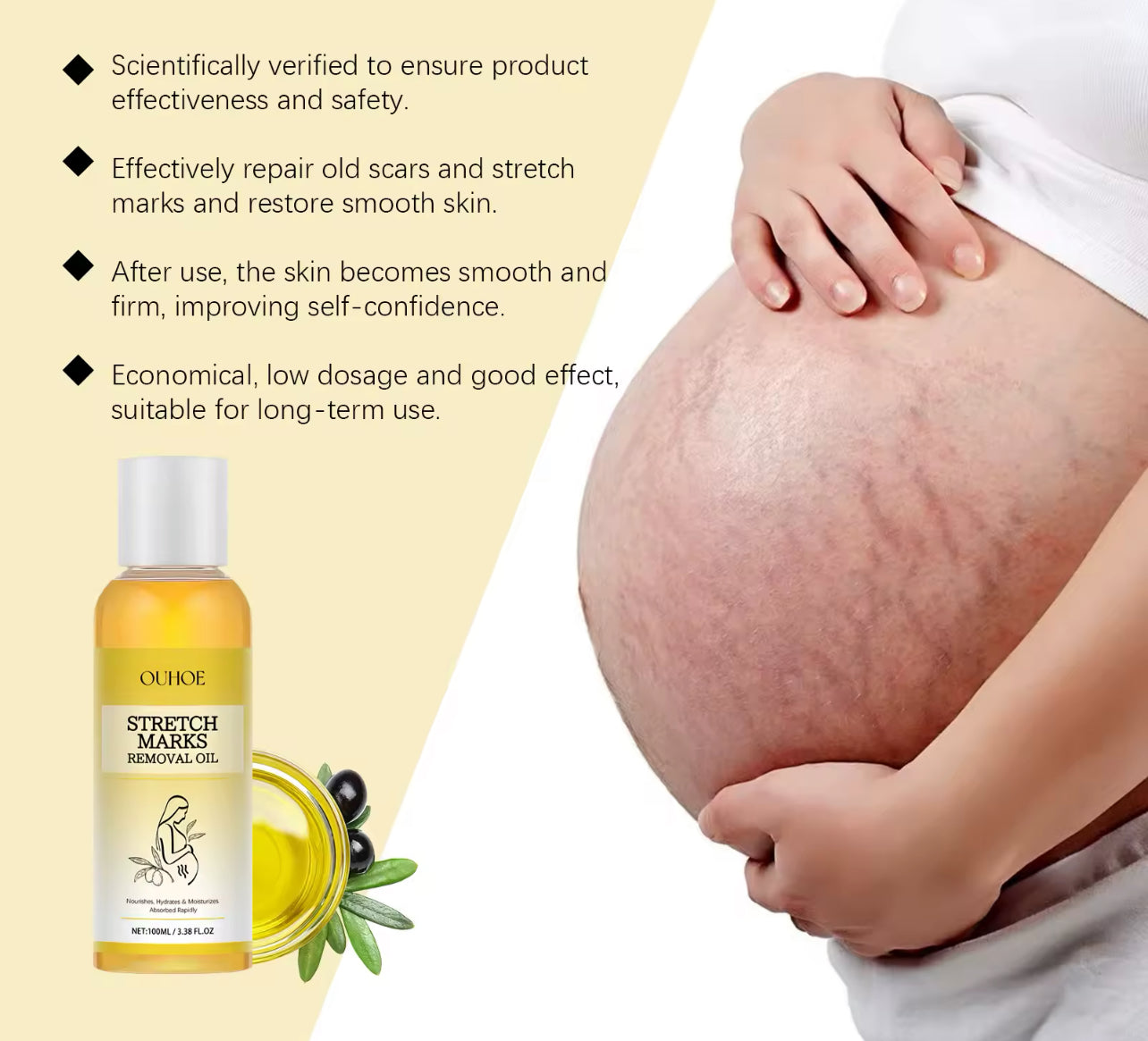 Stretch Mark Lightening Essential Oil Cream Moisturizing & Firming