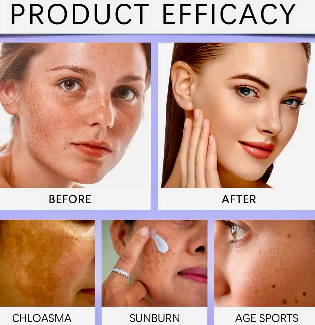 Spot Remover Face Cream Brightening & Firming Skincare