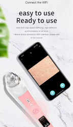 Blackhead Remover with Camera Pore Vacuum Tool with 3 Modes & 6 Heads