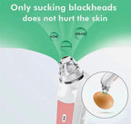 Blackhead Remover with Camera Pore Vacuum Tool with 3 Modes & 6 Heads