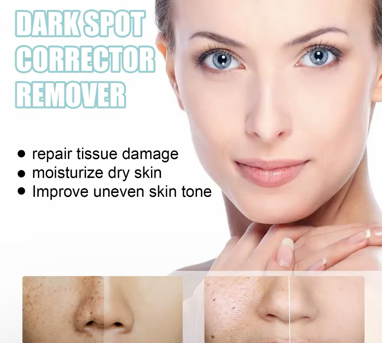 Dark Spot Remover Cream Acne Mark & Blemish Corrector