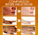 Orange Exfoliating Peeling Lotion Gentle Brightening & Moisturizing Body Cream